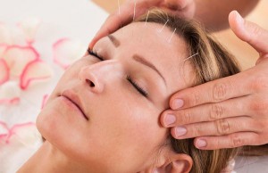 Châm cứu có đau không? Ba nguyên nhân gây đau khi châm cứu