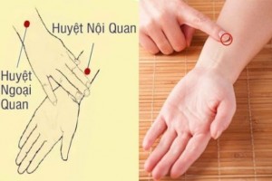 Tác dụng của phương pháp bấm huyệt giúp chữa mất ngủ