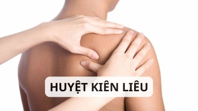 Huyệt Kiên Liêu